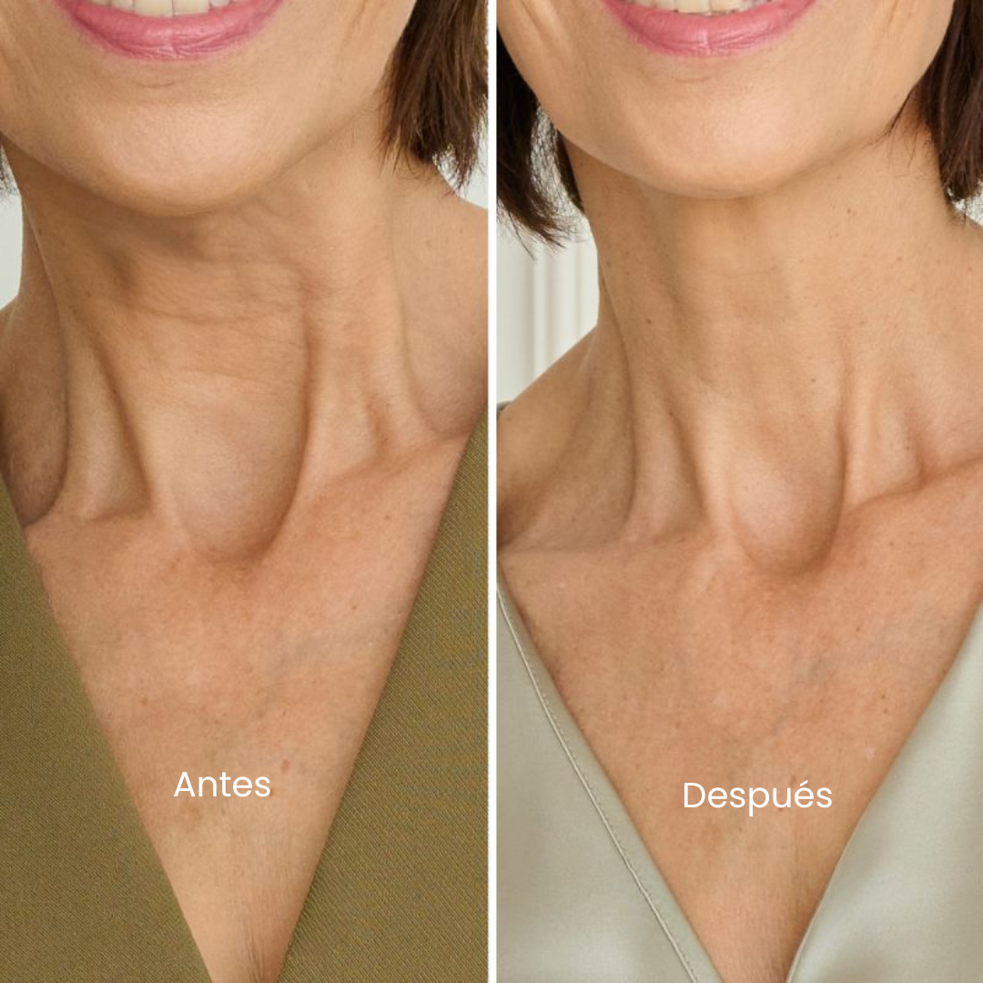 Anti-AgeCreamCuelloyEscote_Conperfume_-SupremeLiftdeLamerantesydespues.png