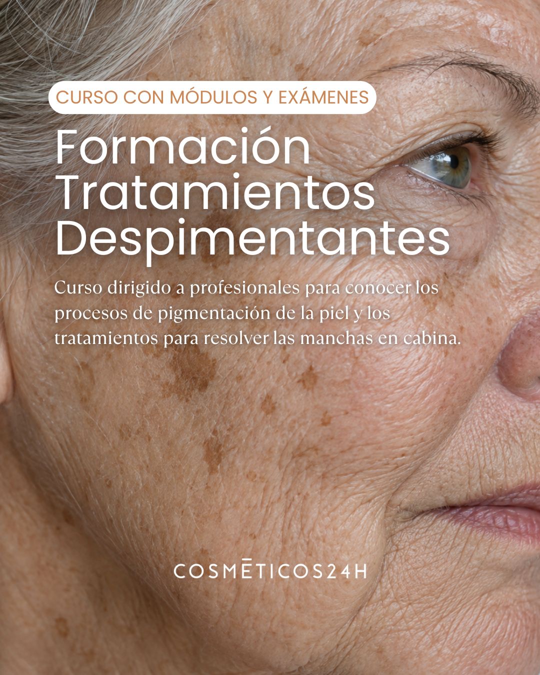 Curso Despigmentantes - Modulos, Exámenes y Título