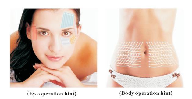 Mesoterapia sin agujas RS F37 — Material del proveedor; configuración y protocolo pendientes de aclarar por discrepancia sobre agujas