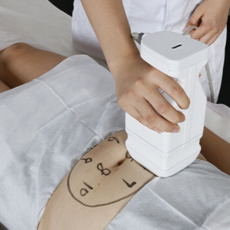 HIFU 7D + Liposonix + Radiofrecuencia Fraccionada RS F58: accesorios (detalle 12)