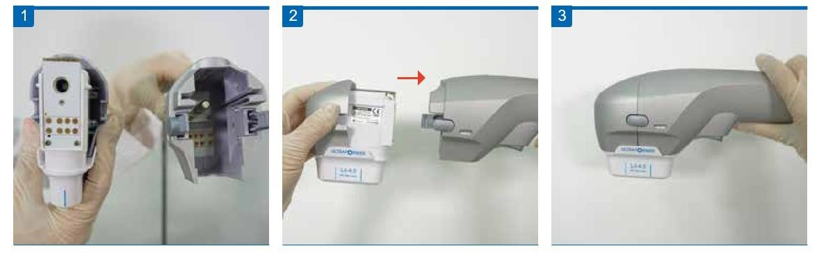 HIFU 7D + Vaginal + Liposonix RS M03-2: accesorios, conexiones o controles; los ajustes son ejemplos, no una pauta individual (detalle 14)