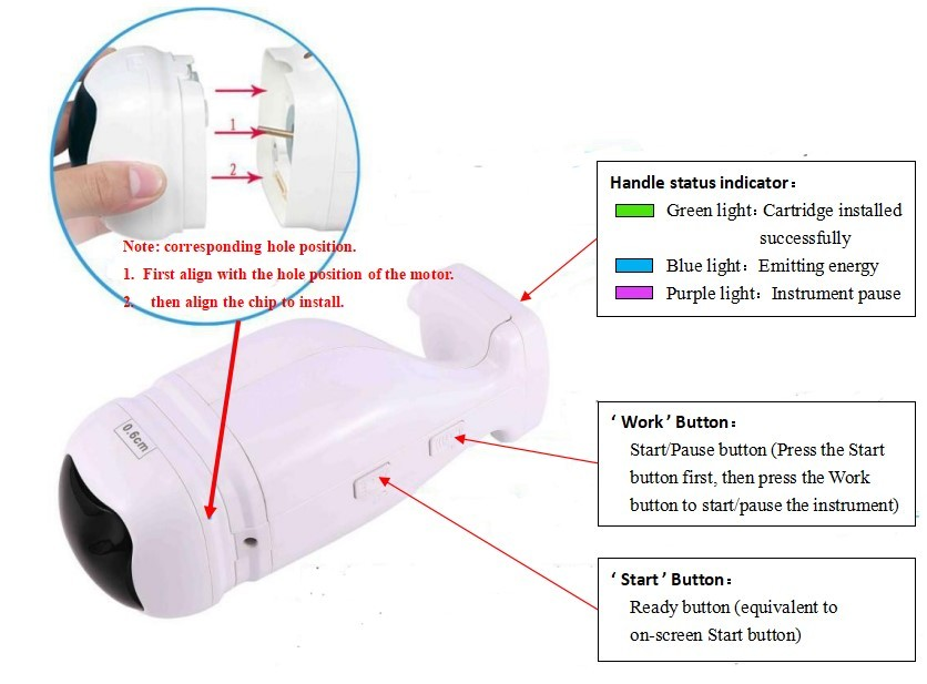 HIFU 7D + Vaginal + Liposonix RS M03-2: accesorios, conexiones o controles; los ajustes son ejemplos, no una pauta individual (detalle 16)