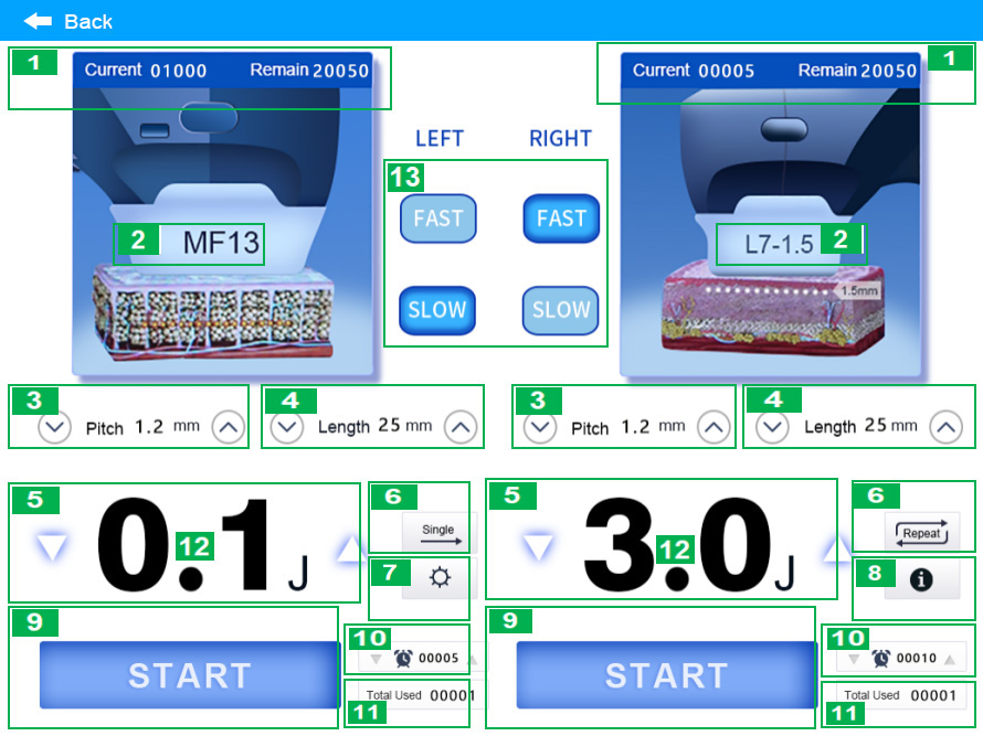 HIFU 7D + Vaginal + Liposonix RS M03-2: accesorios, conexiones o controles; los ajustes son ejemplos, no una pauta individual (detalle 17)
