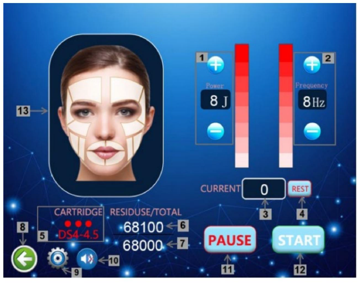HIFU 7D + Liposonix + V-Max RS M03-3: accesorios, conexiones o controles; los ajustes son ejemplos, no una pauta individual (detalle 29)