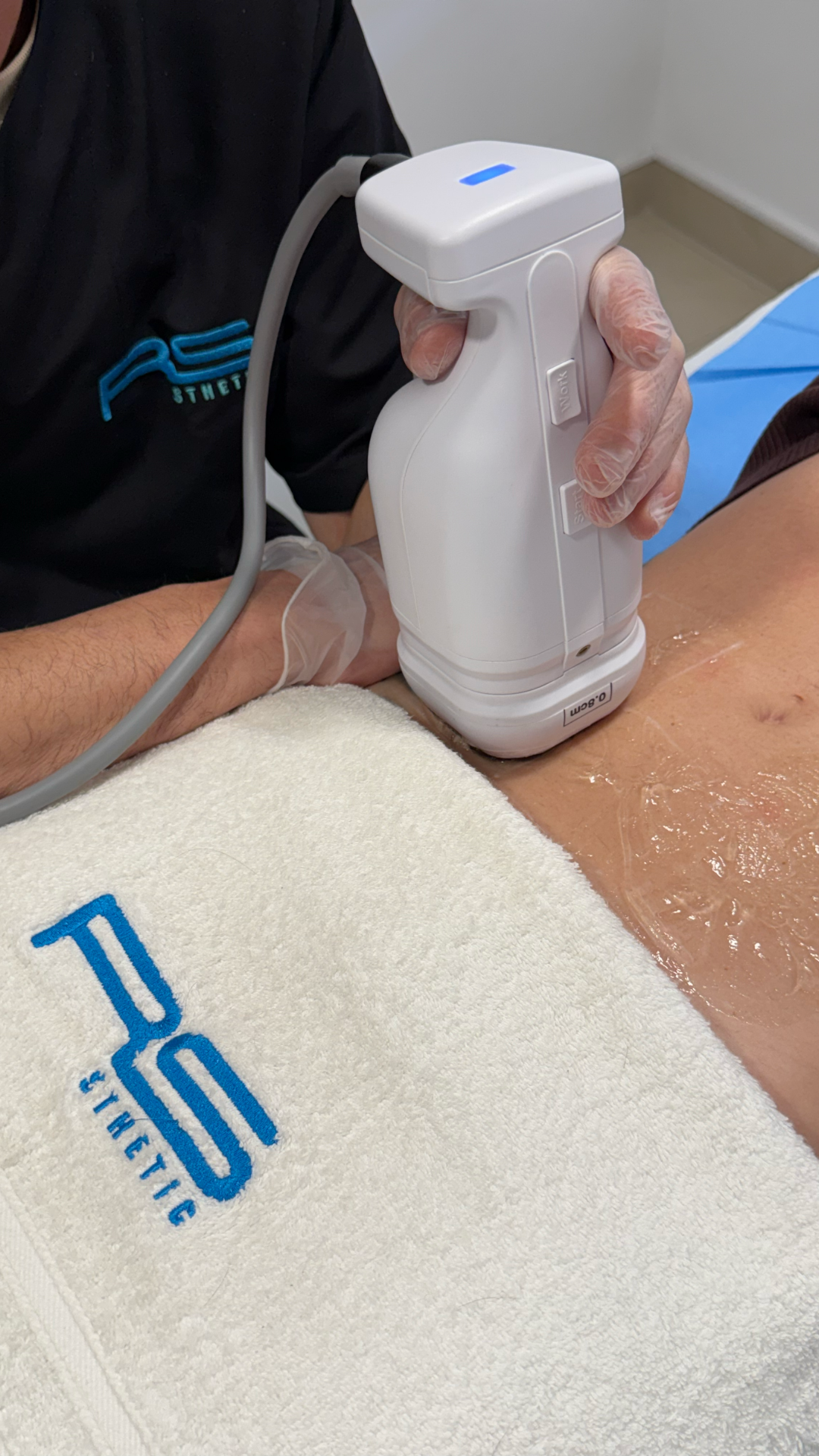 HIFU 7D + Liposonix RS M03: accesorios (detalle 7)