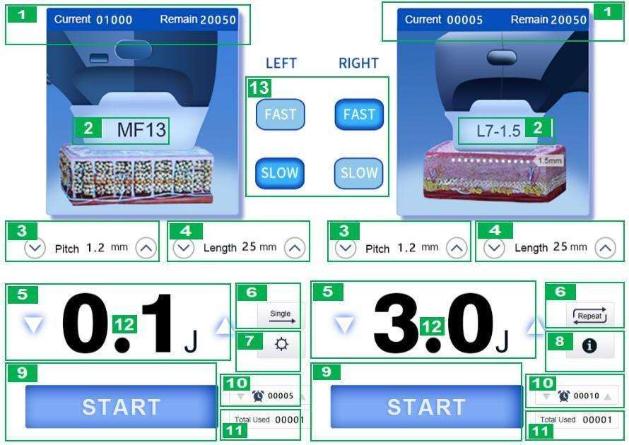 HIFU 7D + Liposonix RS M03: pantalla orientativos de la interfaz, no pauta de ejemplo de aplicación (detalle 16)