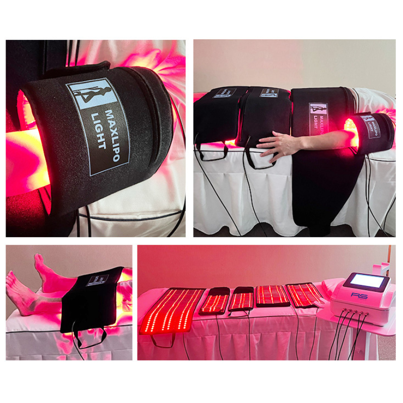 Maxilipo RS MP12: esquema o accesorio
