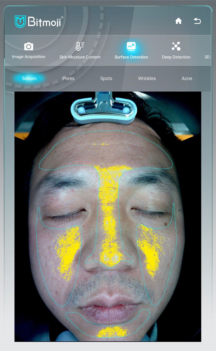 Analizador Facial RS T08: detalle del equipo (detalle 7)